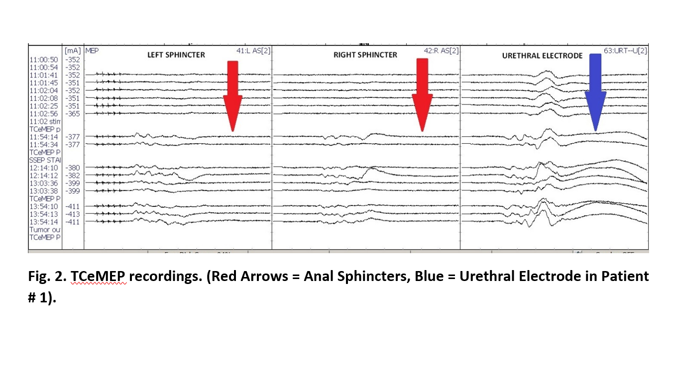 Figure 2.png