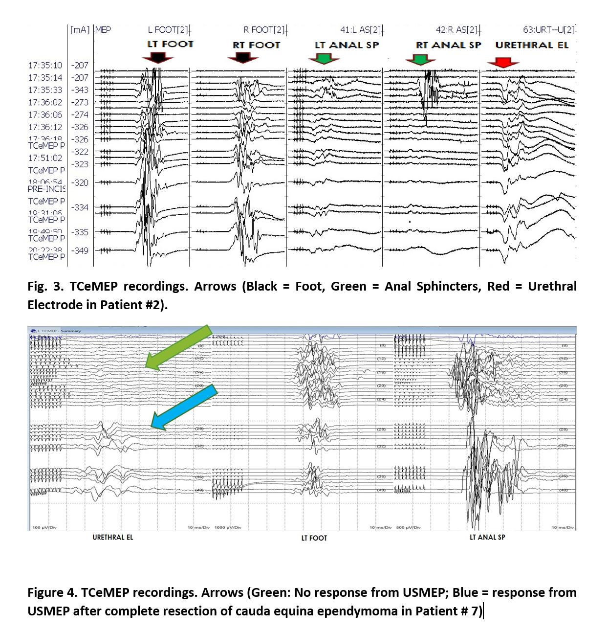 Figure 3 & 4-1.png