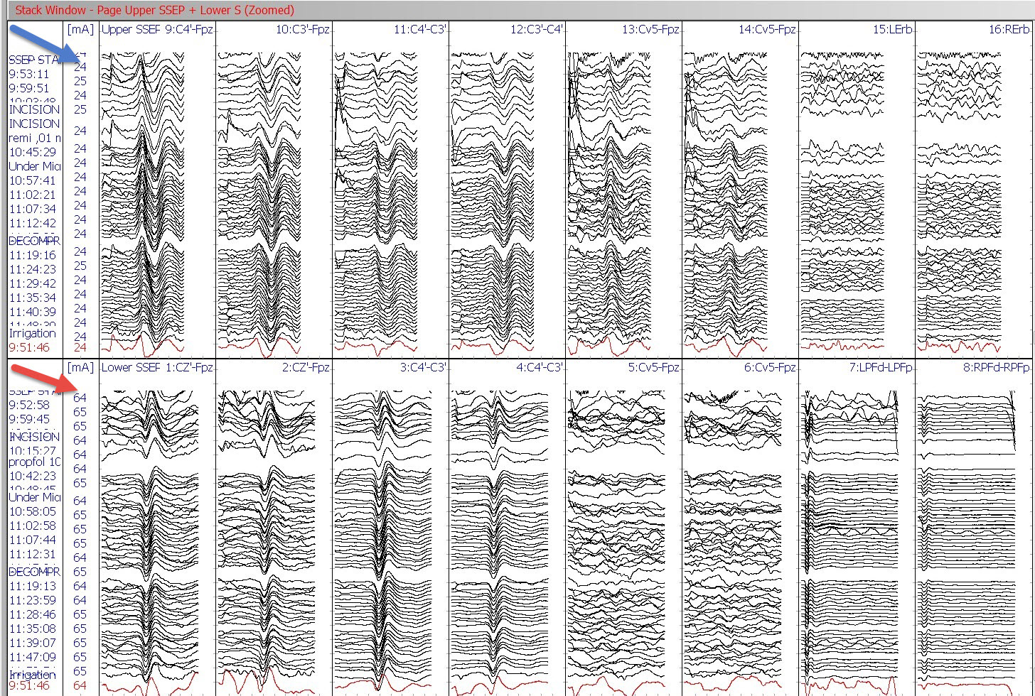 Fig 1. SSEP Stack