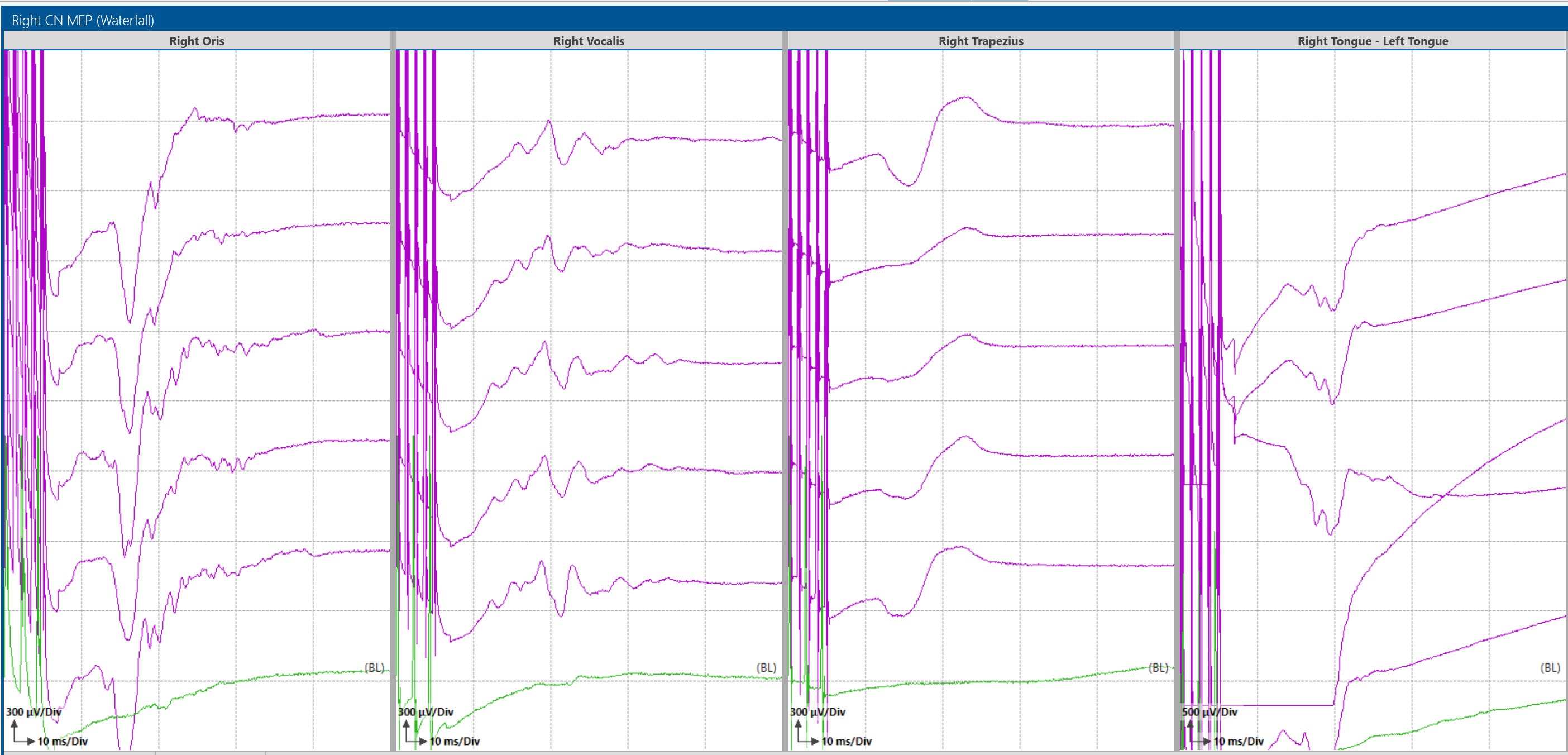 Fig 8. CN MEP