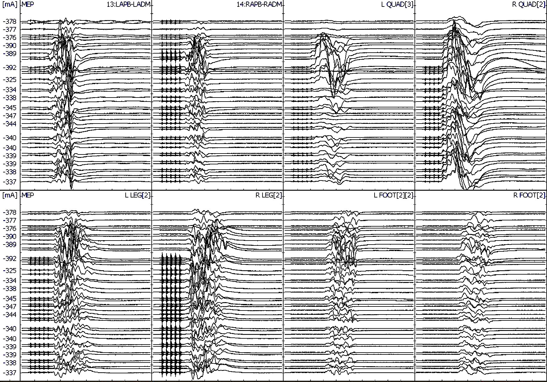 Fig 5. Stage 1 Upper and Lower TCeMEP Stack