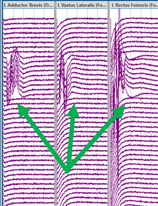 image1-Improving-2