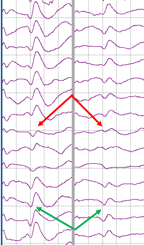 image1-Improving