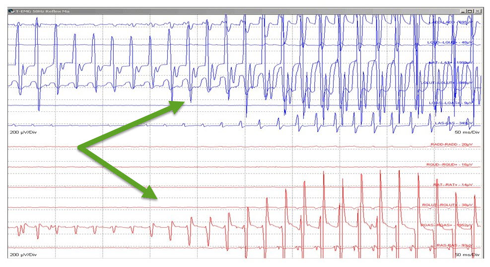 Fig 5. SDR 50 Hz Grade 4 responses